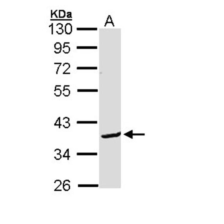 Bcl-2-like protein 12 antibody from Signalway Antibody (22281) - Antibodies.com