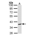 Bcl-2-like protein 12 antibody from Signalway Antibody (22281) - Antibodies.com