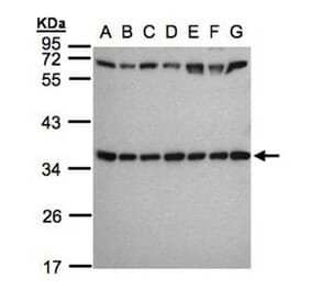 ribosomal protein S3a antibody from Signalway Antibody (22544) - Antibodies.com