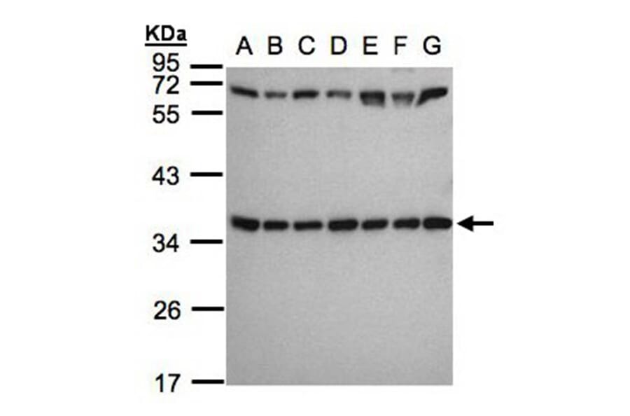 ribosomal protein S3a antibody from Signalway Antibody (22544) - Antibodies.com