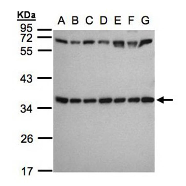 ribosomal protein S3a antibody from Signalway Antibody (22544) - Antibodies.com
