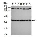 ribosomal protein S3a antibody from Signalway Antibody (22544) - Antibodies.com