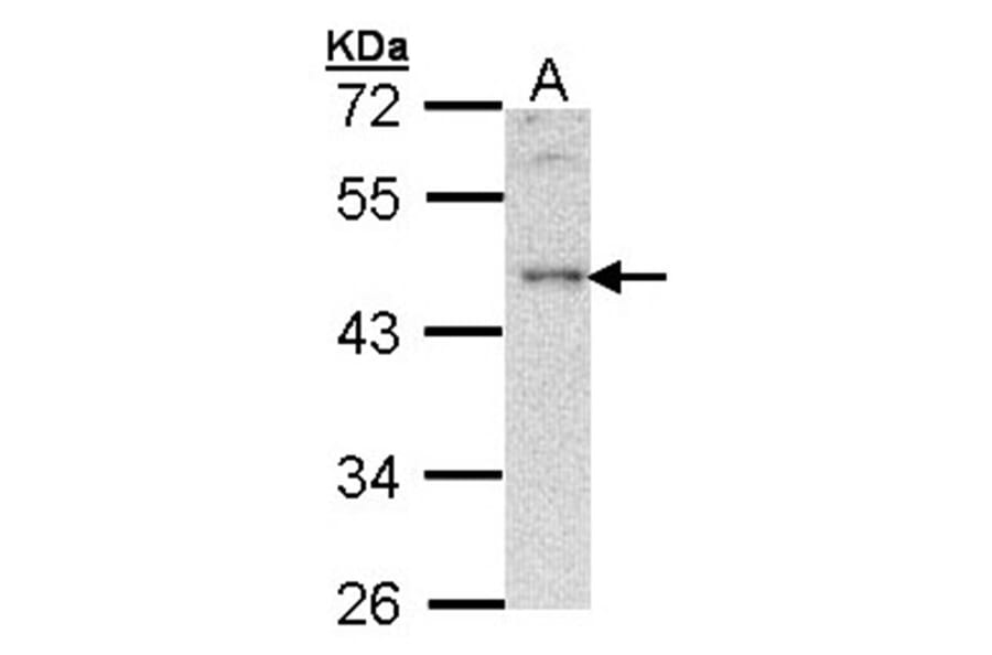 B-cell linker protein antibody from Signalway Antibody (22943) - Antibodies.com