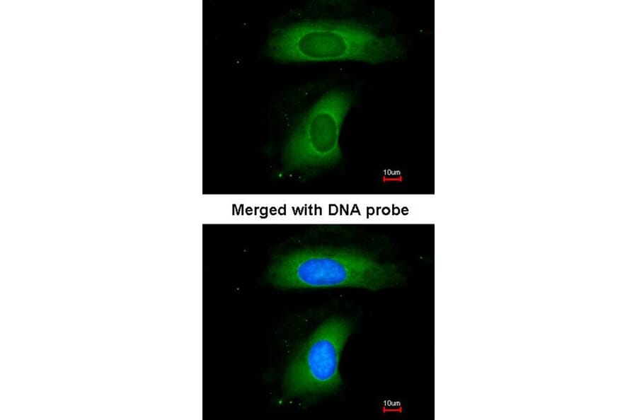 Immunofluorescence - B-cell linker protein antibody from Signalway Antibody (22943) - Antibodies.com