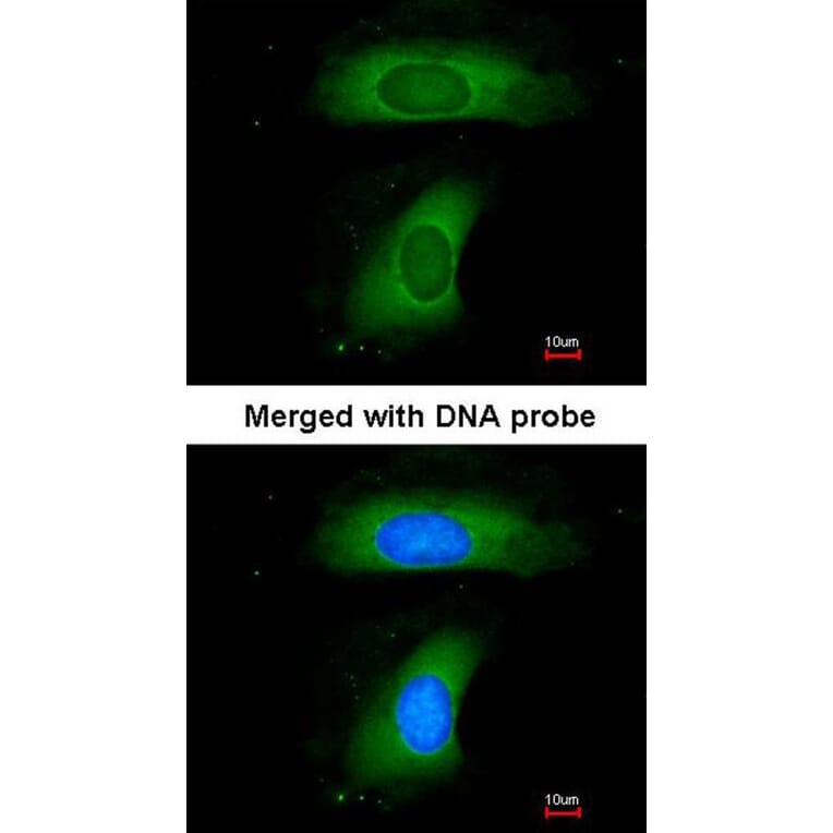 Immunofluorescence - B-cell linker protein antibody from Signalway Antibody (22943) - Antibodies.com