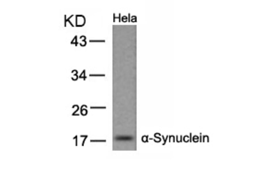 Western blot - a-Synuclein (Ab-133) Antibody from Signalway Antibody (21277) - Antibodies.com