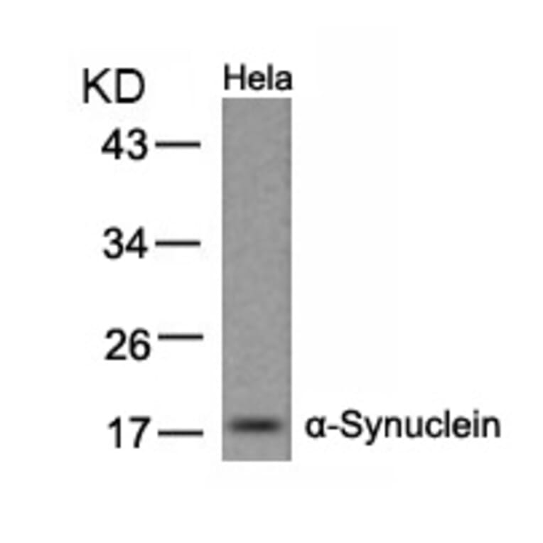 Western blot - a-Synuclein (Ab-133) Antibody from Signalway Antibody (21277) - Antibodies.com