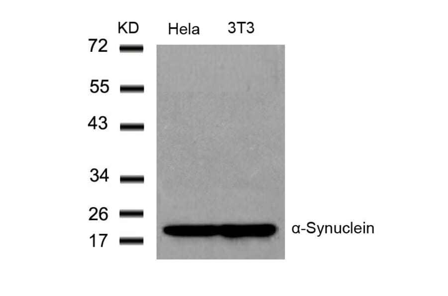 Western blot - a-Synuclein (Ab-136) Antibody from Signalway Antibody (21278) - Antibodies.com