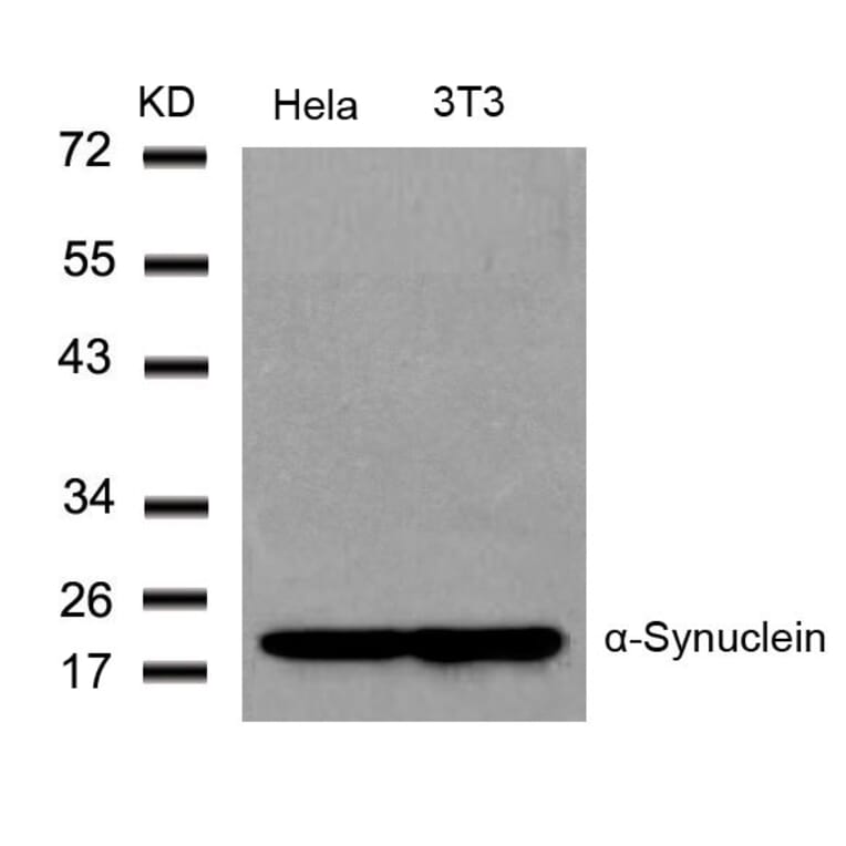Western blot - a-Synuclein (Ab-136) Antibody from Signalway Antibody (21278) - Antibodies.com