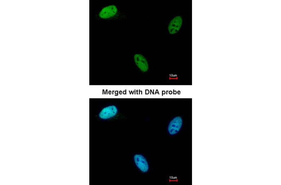 Immunofluorescence - Deoxycytidine kinase antibody from Signalway Antibody (22571) - Antibodies.com