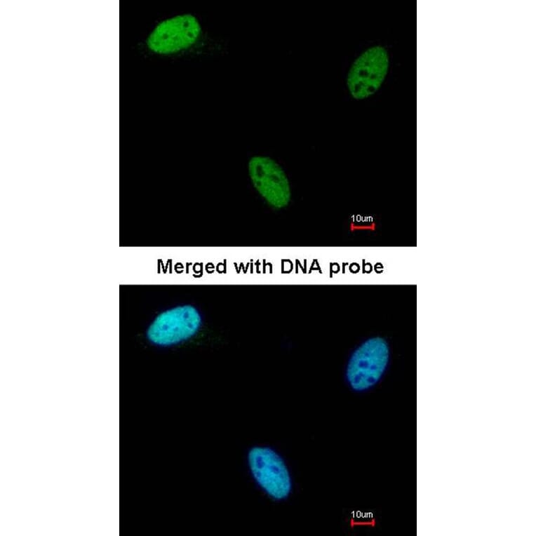 Immunofluorescence - Deoxycytidine kinase antibody from Signalway Antibody (22571) - Antibodies.com