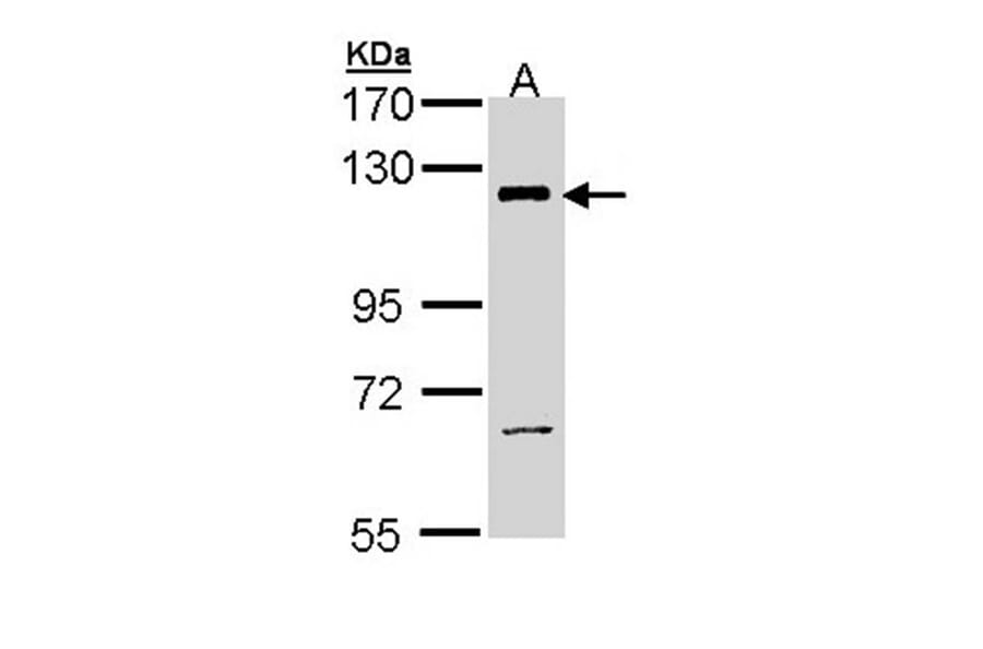 PI3 Kinase p110 beta antibody from Signalway Antibody (22912) - Antibodies.com