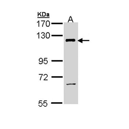 PI3 Kinase p110 beta antibody from Signalway Antibody (22912) - Antibodies.com