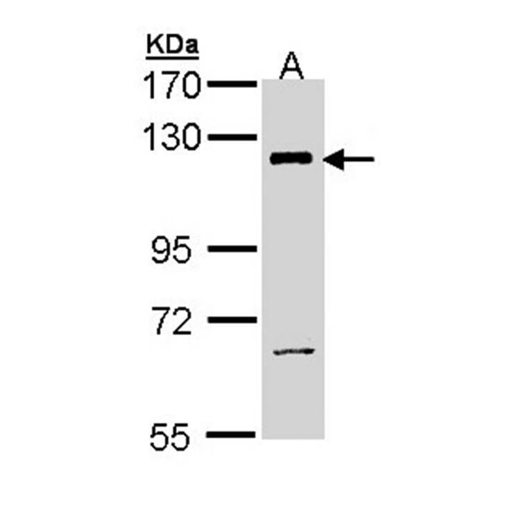 PI3 Kinase p110 beta antibody from Signalway Antibody (22912) - Antibodies.com