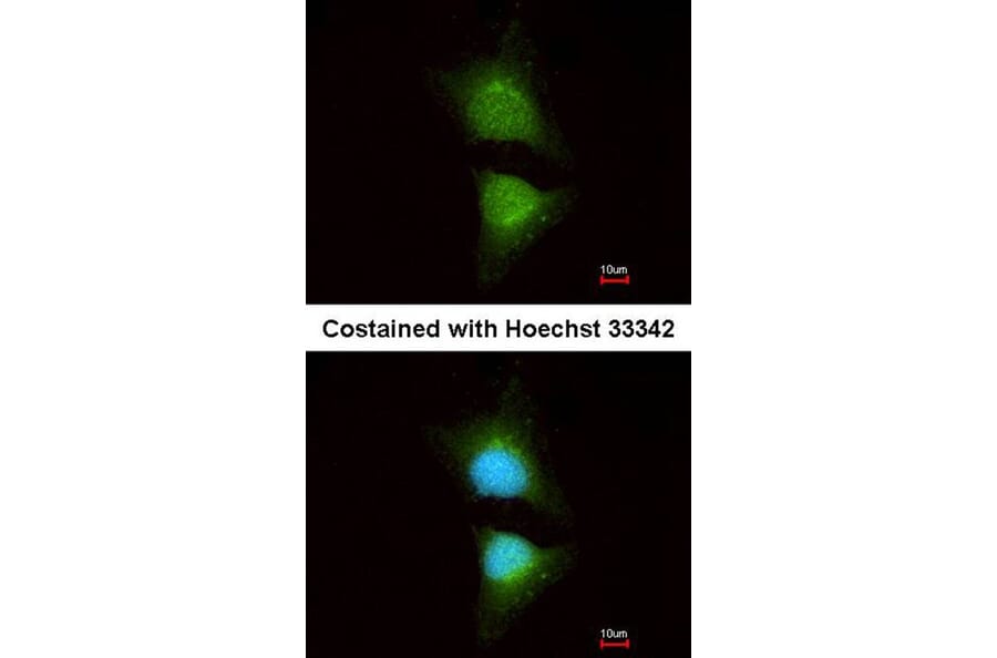 Immunofluorescence - PI3 Kinase p110 beta antibody from Signalway Antibody (22912) - Antibodies.com
