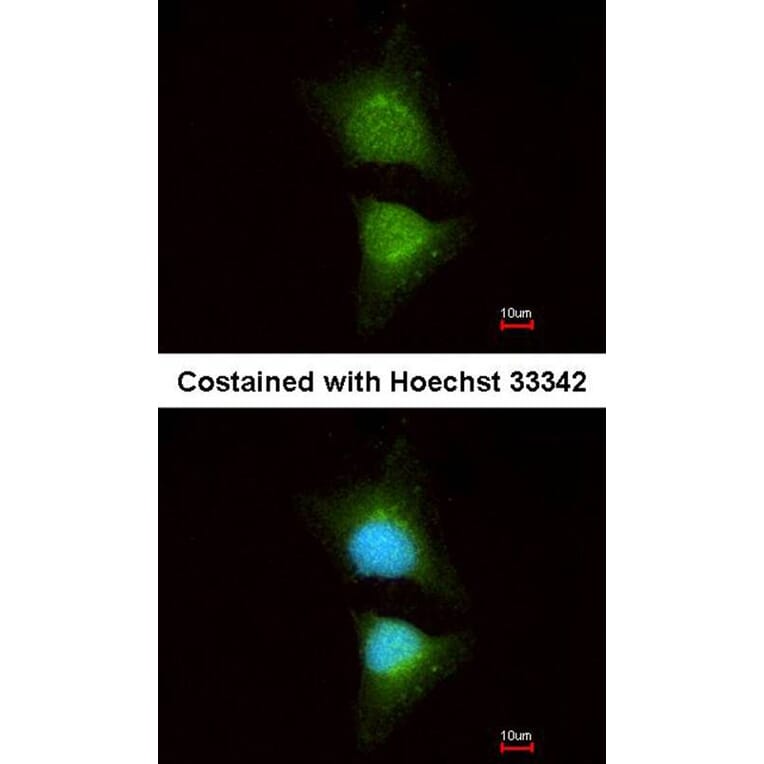 Immunofluorescence - PI3 Kinase p110 beta antibody from Signalway Antibody (22912) - Antibodies.com