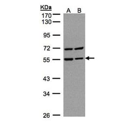 Carbonic anhydrase 9 antibody from Signalway Antibody (22975) - Antibodies.com