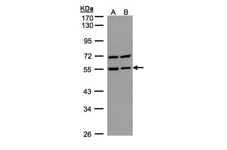 Carbonic anhydrase 9 antibody from Signalway Antibody (22975) - Antibodies.com