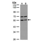 Carbonic anhydrase 9 antibody from Signalway Antibody (22975) - Antibodies.com