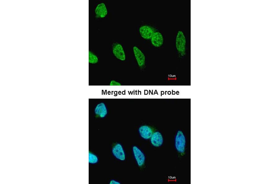 Immunofluorescence - Carbonic anhydrase 9 antibody from Signalway Antibody (22975) - Antibodies.com