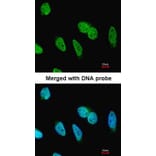 Immunofluorescence - Carbonic anhydrase 9 antibody from Signalway Antibody (22975) - Antibodies.com