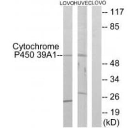 Western blot - Cytochrome P450 39A1 Antibody from Signalway Antibody (34242) - Antibodies.com