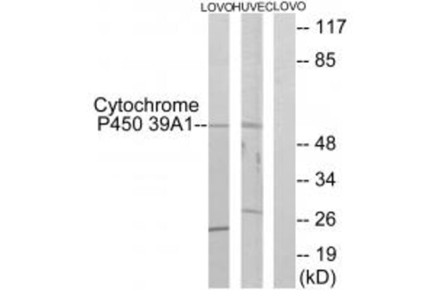 Western blot - Cytochrome P450 39A1 Antibody from Signalway Antibody (34242) - Antibodies.com