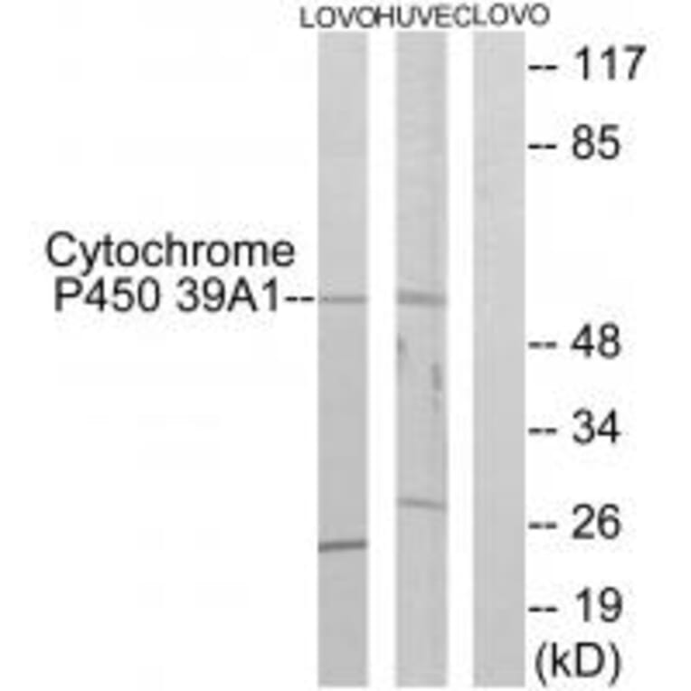 Western blot - Cytochrome P450 39A1 Antibody from Signalway Antibody (34242) - Antibodies.com