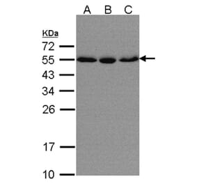 karyopherin alpha 2 antibody from Signalway Antibody (22844) - Antibodies.com