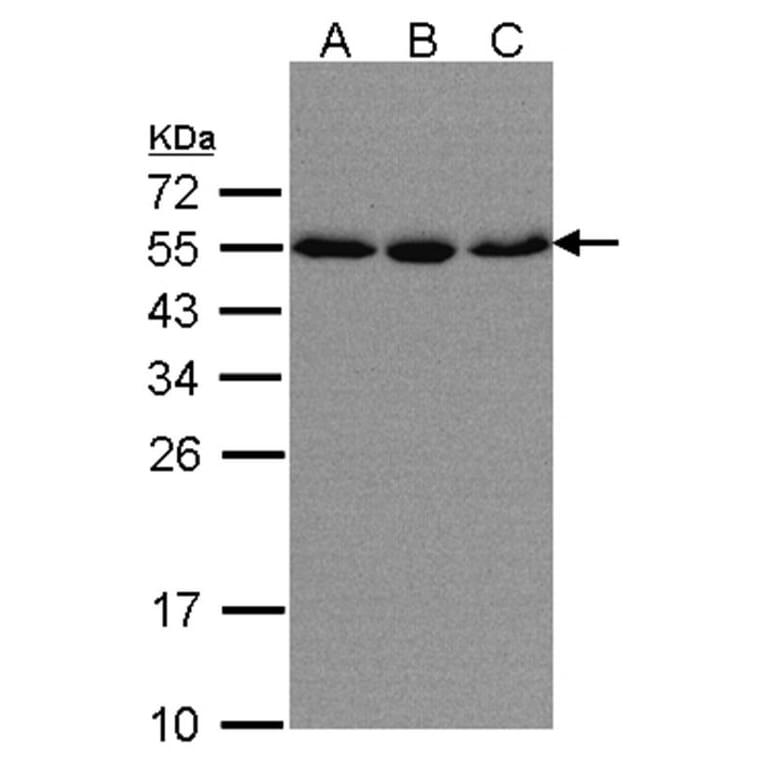 karyopherin alpha 2 antibody from Signalway Antibody (22844) - Antibodies.com