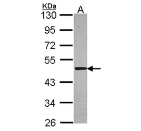 Syntrophin alpha 1 antibody from Signalway Antibody (22845) - Antibodies.com