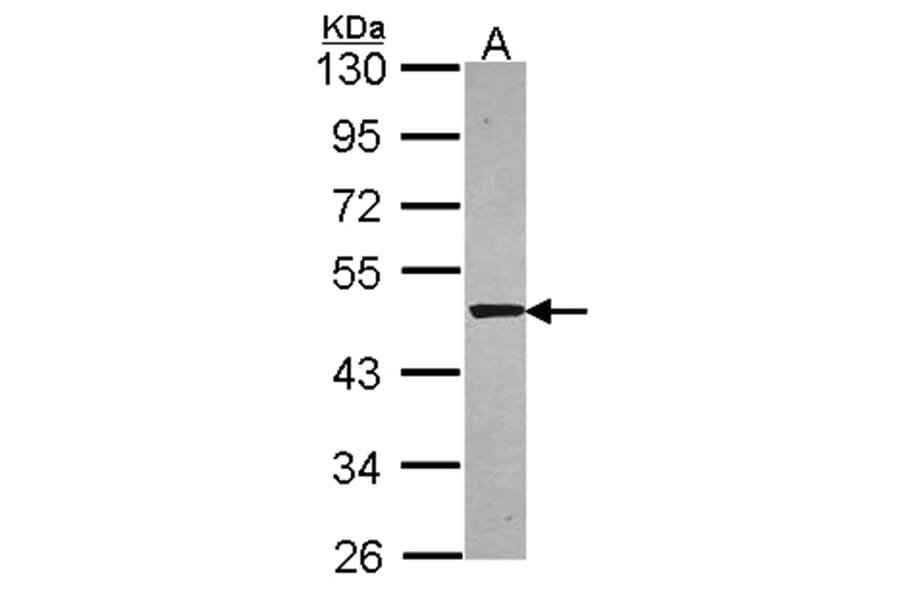 Syntrophin alpha 1 antibody from Signalway Antibody (22845) - Antibodies.com