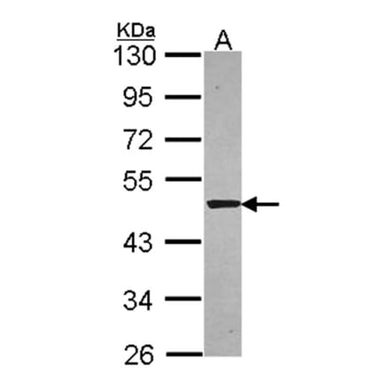 Syntrophin alpha 1 antibody from Signalway Antibody (22845) - Antibodies.com