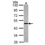 Syntrophin alpha 1 antibody from Signalway Antibody (22845) - Antibodies.com