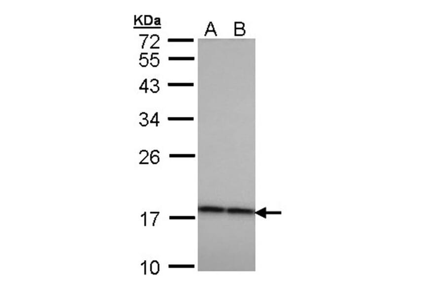 Beta-crystallin A4 antibody from Signalway Antibody (22987) - Antibodies.com