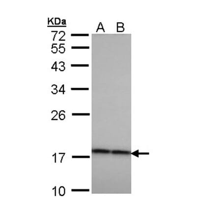 Beta-crystallin A4 antibody from Signalway Antibody (22987) - Antibodies.com