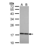 Beta-crystallin A4 antibody from Signalway Antibody (22987) - Antibodies.com