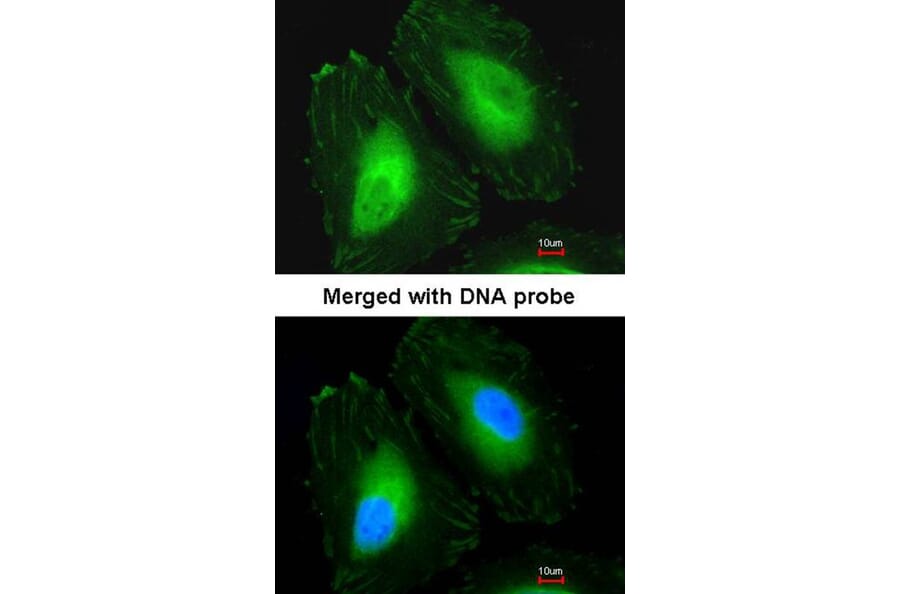 Immunofluorescence - Beta-crystallin A4 antibody from Signalway Antibody (22987) - Antibodies.com