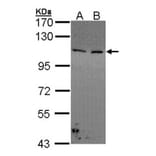 Collagen I alpha2 antibody from Signalway Antibody (22540) - Antibodies.com