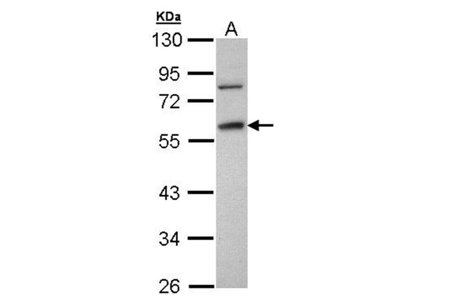 Fibrinogen gamma antibody from Signalway Antibody (22542) - Antibodies.com