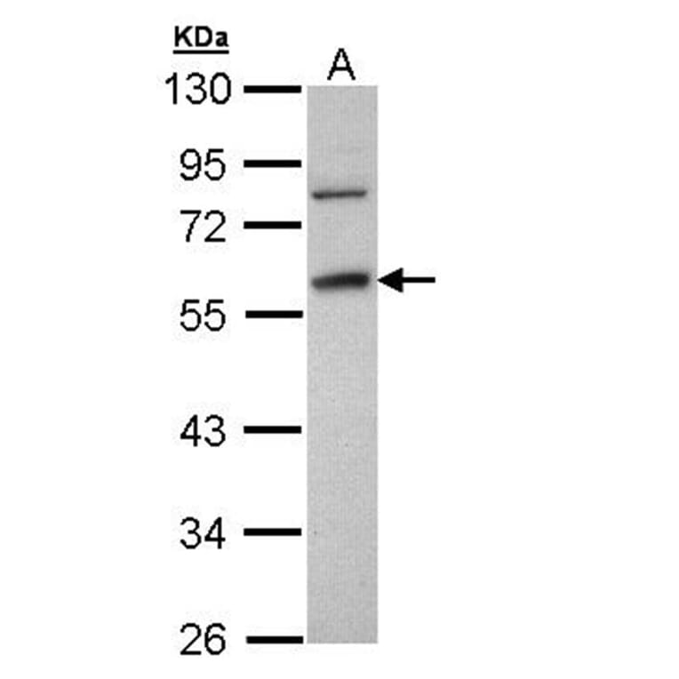 Fibrinogen gamma antibody from Signalway Antibody (22542) - Antibodies.com