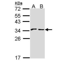 NKG2-A (CD159a) antibody from Signalway Antibody (22434) - Antibodies.com