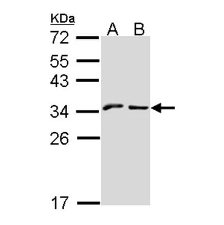 NKG2-A (CD159a) antibody from Signalway Antibody (22434) - Antibodies.com