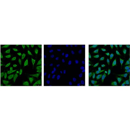 HSP70 Monoclonal Antibody from Signalway Antibody (40416) - Antibodies.com