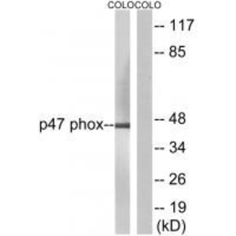 Western blot - Neutrophil Cytosol Factor 1 (Ab-304) Antibody from Signalway Antibody (33180) - Antibodies.com