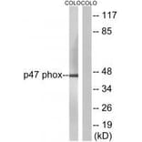 Western blot - Neutrophil Cytosol Factor 1 (Ab-304) Antibody from Signalway Antibody (33180) - Antibodies.com