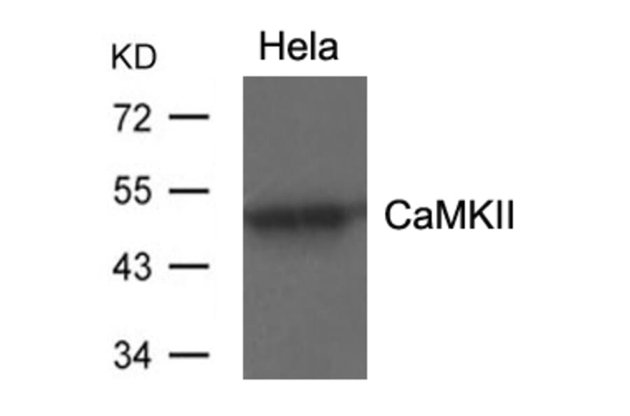 Western blot - CaMKII (Ab-286) Antibody from Signalway Antibody (21279) - Antibodies.com