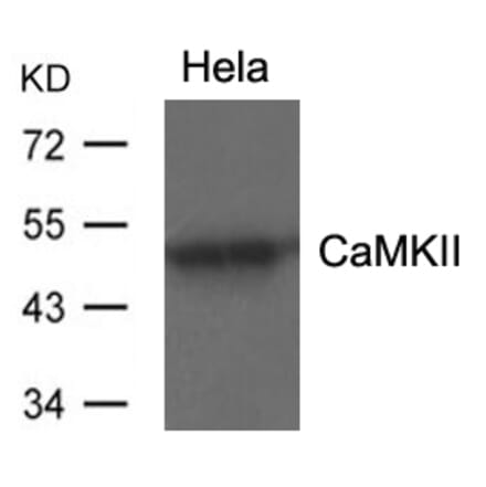 Western blot - CaMKII (Ab-286) Antibody from Signalway Antibody (21279) - Antibodies.com