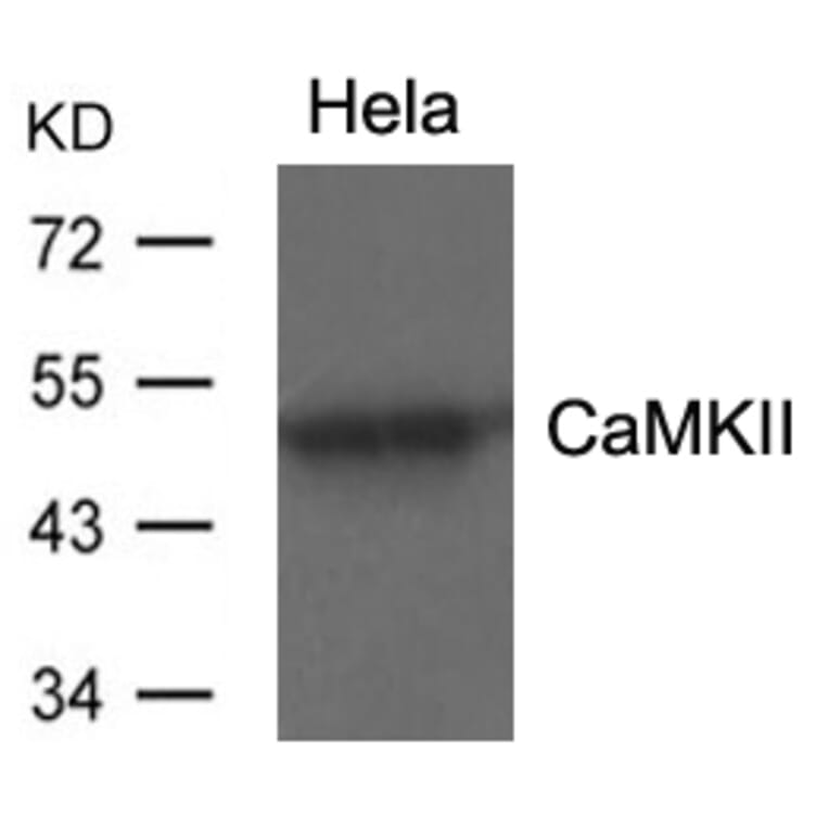 Western blot - CaMKII (Ab-286) Antibody from Signalway Antibody (21279) - Antibodies.com