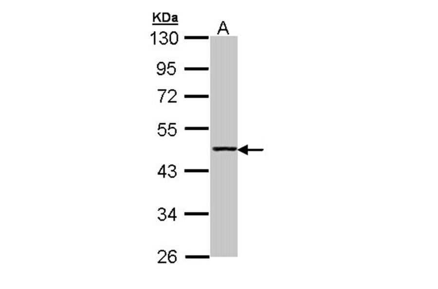 Aminoacylase-1 antibody from Signalway Antibody (22151) - Antibodies.com